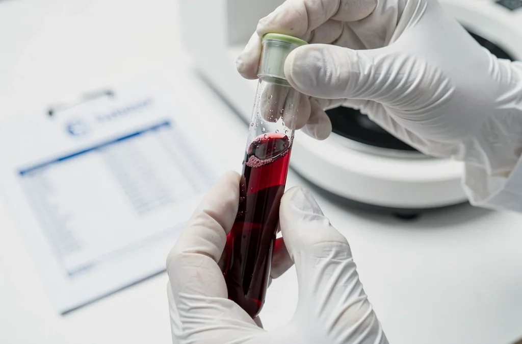 Technicien de laboratoire tenant un tube de sang pour analyse des globules rouges après test sportif